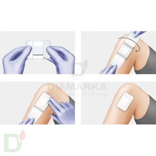 Пластырь COSMOPOR E на нетканой основе 10х 6см №1