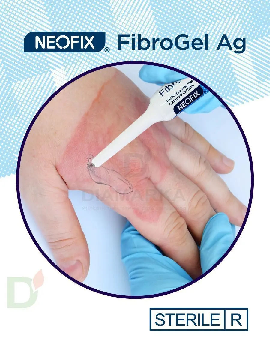 Гидрогель антимикробный NEOFIX FibroGel Fg с ионами серебра 15г в Екатеринбурге
